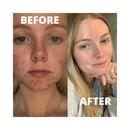 Boost Lab Vitamin B3 Blemish Rescue Serum 30ml