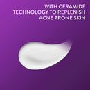 Cetaphil Pro Acne Prone Oil-Free Moisturising Lotion SPF25 118ml