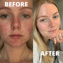 Boost Lab Vitamin B3 Blemish Rescue Serum 30ml