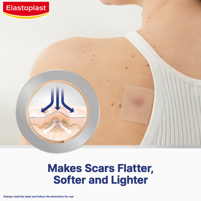 Elastoplast scar treatment patch on a person's shoulder with branding and text.