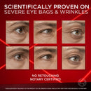 Before and after effects of an eye treatment on severe eye bags and wrinkles with a red background.