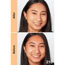 Before and after comparison of a woman's face with 'After' on the left and 'Before' on the right.