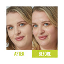 Before and after comparison of a woman's face with 'After' on the left and 'Before' on the right.