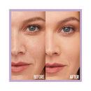 Before and after comparison of a woman's face with visible skin improvement.